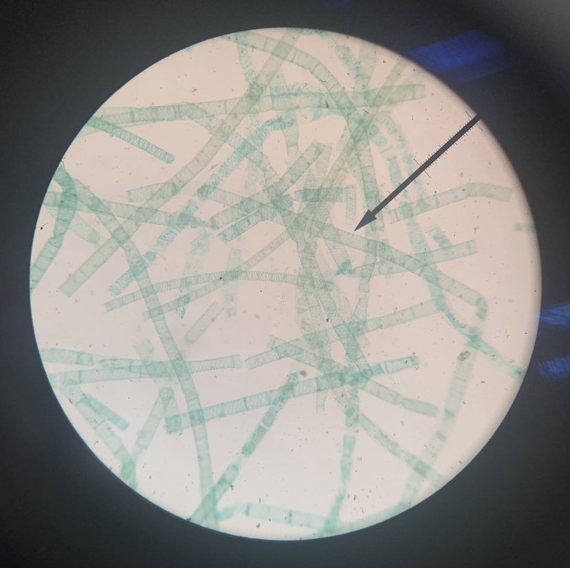 Spirogyra 40x