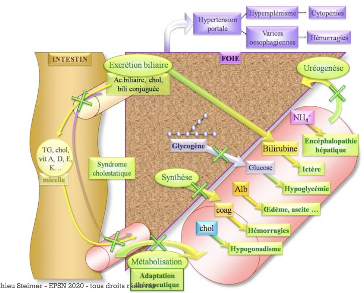 Insuffisance hépatique