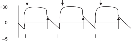 Ventilación presión soporte(PSV)