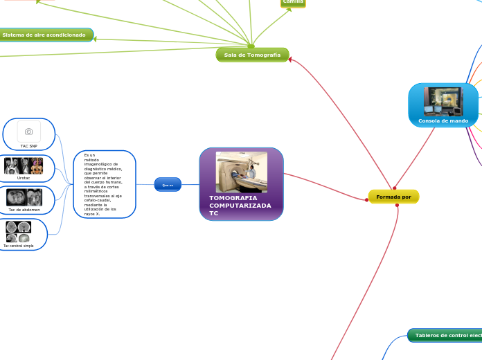 TOMOGRAFIA COMPUTARIZADA TC