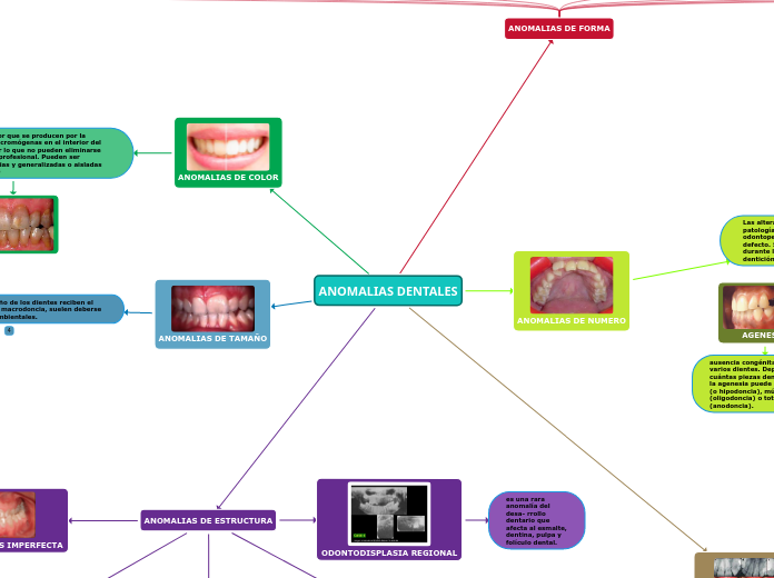 ANOMALIAS DENTALES - Mind Map